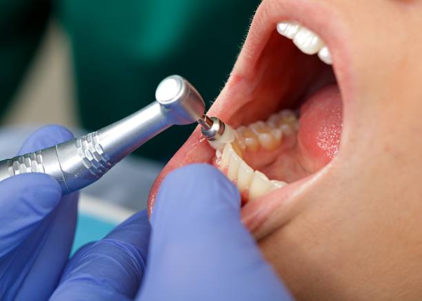 Best Wisdom Tooth Removal  in Los Lunas, NM